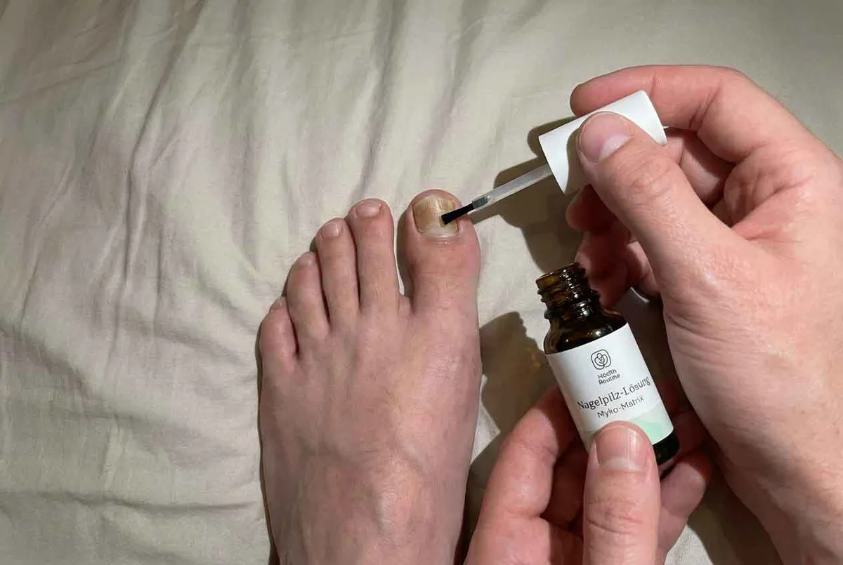Myko-Matrix Nagelpilz-Lösung im 10 ml Fläschchen mit Pinsel-Applikator
